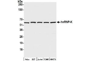 Western Blotting (WB) image for anti-Heterogeneous Nuclear Ribonucleoprotein K (HNRNPK) (C-Term) antibody (ABIN7454660)