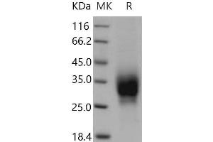 Western Blotting (WB) image for TNF Receptor Superfamily, Member 6 (FAS) (Active) protein (His tag) (ABIN7320430)