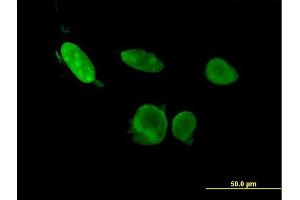 anti-Ets2 Repressor Factor (ERF) (AA 181-290) antibody