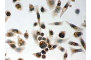 IHC analysis of CLOCK using anti-CLOCK antibody .