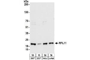 anti-Ribosomal Protein L11 (RPL11) (AA 128-178) antibody