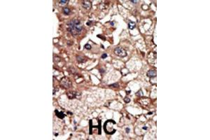 Immunohistochemistry (IHC) image for anti-Epidermal Growth Factor Receptor Pathway Substrate 8 (EPS8) antibody (ABIN3003718) (EPS8 anticorps)