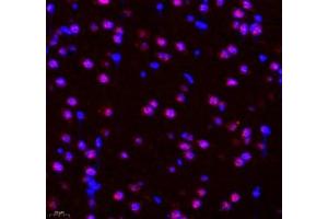 Immunofluorescence of paraffin embedded rat brain using PRPF3 (ABIN7075311) at dilution of 1: 2200 (400x lens)