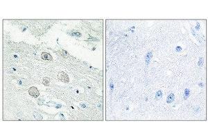 Immunohistochemistry (IHC) image for anti-Janus Kinase 1 (JAK1) (N-Term) antibody (ABIN1849256) (JAK1 anticorps  (N-Term))