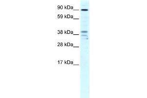 Human Liver; WB Suggested Anti-ZC3H7B Antibody Titration: 4ug/ml.