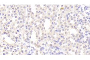 Detection of TJP1 in Rat Kidney Tissue using Polyclonal Antibody to Tight Junction Protein 1 (TJP1)