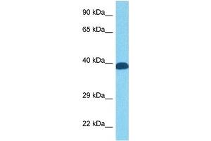 Host:  Rabbit  Target Name:  FOS  Sample Tissue:  Human PANC1 Whole Cell  Antibody Dilution:  1ug/ml (c-FOS anticorps  (N-Term))