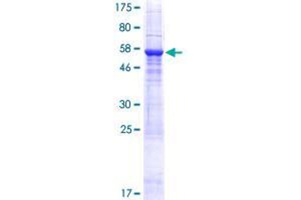 SUSD4 Protein (AA 1-290) (GST tag)