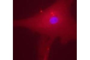 Immunofluorescent staining of MLXIPL in human hepatocyte using MLXIPL polyclonal antibody .