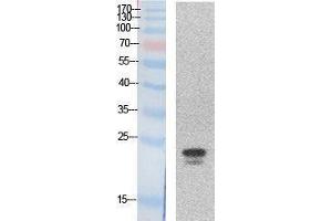 Western Blotting (WB) image for anti-Sex Determining Region Y (SRY) (Internal Region) antibody (ABIN3181048) (SRY anticorps  (Internal Region))