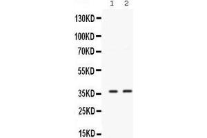 Western blot analysis of SIX1 expression in MCF-7 whole cell lysates (lane 1) and 22RV1 whole cell lysates (lane 2). (SIX Homeobox 1 anticorps  (C-Term))