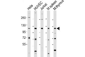 All lanes : Anti-DDX58 C-term  at 1:2000 dilution Lane 1: Hela whole cell lysate Lane 2: HUVEC whole cell lysate Lane 3: Jurkat whole cell lysate Lane 4: mouse spleen lysate Lane 5: mouse thymus lysate Lysates/proteins at 20 μg per lane. (DDX58 anticorps  (C-Term))