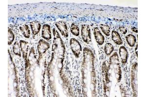 IHC analysis of Musashi 1/Msi1 using anti- Musashi 1/Msi1 antibody .