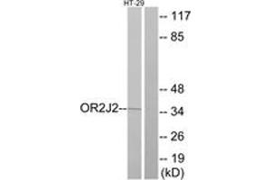 Western blot analysis of extracts from HT-29 cells, using OR2J2 Antibody. (OR2J2 anticorps  (AA 263-312))
