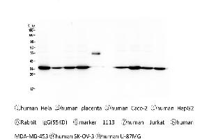 Western blot analysis of Emerin using anti-Emerin antibody . (Emerin anticorps  (N-Term))