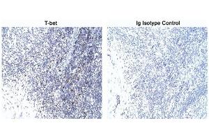 Immunohistochemistry (IHC) image for anti-T-Bet antibody (ABIN967672)