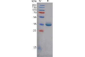 Human EREG Protein, hFc Tag on SDS-PAGE under reducing condition.