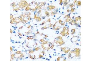 Immunohistochemistry of paraffin-embedded Human stomach using ARHGEF5 Polyclonal Antibody at dilution of 1:100 (40x lens). (ARHGEF5 anticorps)