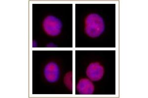 KLF5 antibody (pAb) tested by Immunofluorescence.