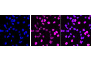 anti-Docking Protein 1, 62kDa (Downstream of tyrosine Kinase 1) (DOK1) antibody