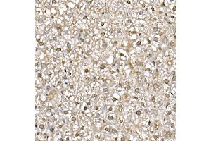 Immunohistochemistry of paraffin-embedded mouse liver using UB Rabbit mAb (ABIN7271128) at dilution of 1:50 (40x lens). (UBA52 anticorps)