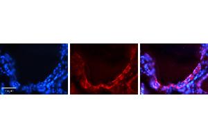 Rabbit Anti-GJA1 Antibody   Formalin Fixed Paraffin Embedded Tissue: Human Thyroid Gland Tissue Observed Staining: Plasma membrane Primary Antibody Concentration: 1:100 Other Working Concentrations: N/A Secondary Antibody: Donkey anti-Rabbit-Cy3 Secondary Antibody Concentration: 1:200 Magnification: 20X Exposure Time: 0. (Connexin 43/GJA1 anticorps  (Middle Region))