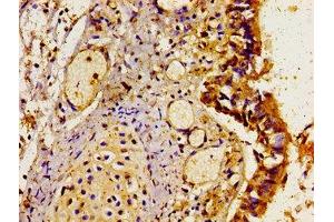 Immunohistochemistry of paraffin-embedded human lung tissue using ABIN7158808 at dilution of 1:100 (LAMP3 anticorps  (AA 28-224))