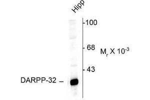 Image no. 1 for anti-Protein Phosphatase 1, Regulatory (Inhibitor) Subunit 1B (PPP1R1B) (N-Term) antibody (ABIN372605) (DARPP32 anticorps  (N-Term))