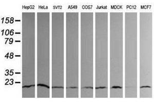Image no. 8 for anti-Ubiquitin-Conjugating Enzyme E2G 2 (UBE2G2) antibody (ABIN1501630)