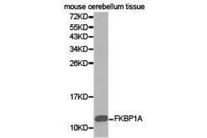 Western Blotting (WB) image for anti-FK506 Binding Protein 1A, 12kDa (FKBP1A) antibody (ABIN1872697) (FKBP1A anticorps)