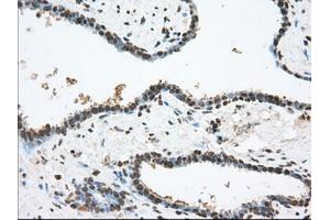 Image no. 1 for anti-Transforming, Acidic Coiled-Coil Containing Protein 3 (TACC3) antibody (ABIN1498099) (TACC3 anticorps)