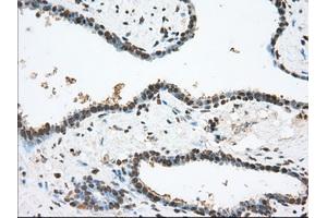 Image no. 1 for anti-Transforming, Acidic Coiled-Coil Containing Protein 3 (TACC3) antibody (ABIN1498099)