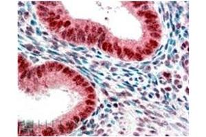 Image no. 1 for anti-Chromobox Homolog 5 (CBX5) (Internal Region) antibody (ABIN374617) (CBX5 anticorps  (Internal Region))
