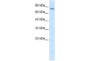 KCNN3 anticorps  (C-Term)