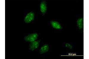Immunofluorescence of purified MaxPab antibody to ANXA4 on HeLa cell. (Annexin IV anticorps  (AA 1-321))
