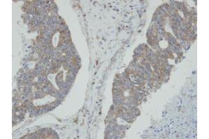 anti-N-Myc (And STAT) Interactor (NMI) antibody