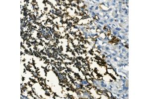 IHC analysis of CD20/MS4A1 using anti-CD20/MS4A1 antibody (ABIN7599233). (CD20 anticorps  (AA 1-297))