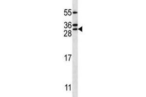 RAB5C antibody western blot analysis in Jurkat lysate. (Rab5c anticorps  (AA 178-207))