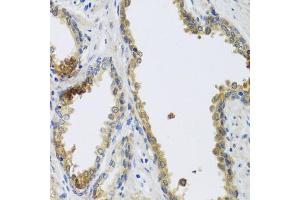 Immunohistochemistry of paraffin-embedded human prostate using GFER antibody. (GFER anticorps)