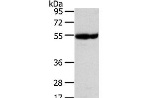 Western Blot analysis of Human placenta tissue using UBAP1 Polyclonal Antibody at dilution of 1/400 (UBAP1 anticorps)