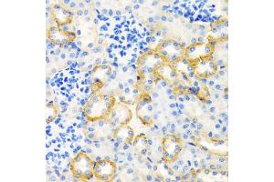 Immunohistochemistry of paraffin-embedded rat kidney using STC1 antibody (ABIN5975425) at dilution of 1/100 (40x lens). (Stanniocalcin 1 anticorps)