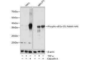 Western blot analysis of extracts of various cell lines, using Phospho-eIF2α-S51 Rabbit mAb (ABIN6135266, ABIN6136152, ABIN6136153 and ABIN7101882) at 1:1000 dilution.