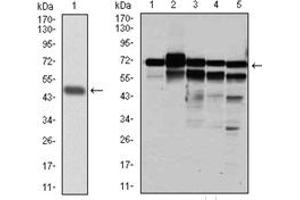 Western Blotting (WB) image for anti-Replication Protein A1, 70kDa (RPA1) antibody (ABIN1108896) (RPA1 anticorps)