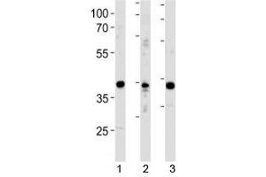 NeuroD1 antibody western blot analysis in 1) Y79 cell line, 2) mouse cerebellum and 3) rat brain tissue lysate. (NEUROD1 anticorps  (AA 318-348))