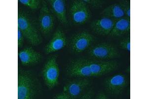 IF analysis of SH2D4A using anti-SH2D4A antibody (ABIN7601695). (SH2D4A anticorps  (AA 42-454))