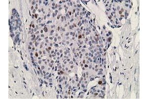 Image no. 5 for anti-Deoxycytidine Kinase (DCK) antibody (ABIN1497775)