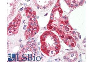 ABIN940551 (5µg/ml) staining of paraffin embedded Human Kidney. (SLC6A8 anticorps  (Internal Region))