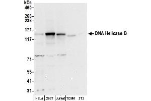 anti-DNA Helicase B (HELB) (AA 1037-1087) antibody