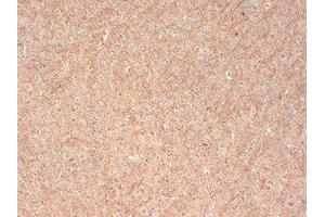 CASPR Immunohistochemistry.