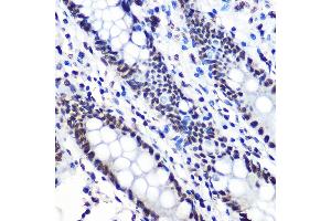 Immunohistochemistry of paraffin-embedded human colon using Phospho-IκBα-S36 Rabbit mAb (ABIN7268992) at dilution of 1:100 (40x lens).